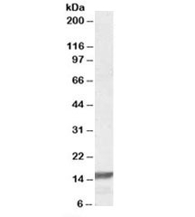 Western blot testing of K562 lysate with RPS19 antibody at 0.1ug/ml. Predicted molecular weight: ~16kDa.