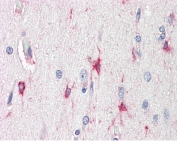 IHC testing of FFPE human brain (cortex) tissue with BAG3 antibody at 5ug/ml. Required HIER: steamed antigen retrieval with pH6 citrate buffer; AP-staining.