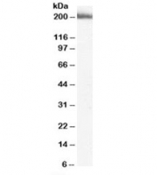 Western blot testing of human liver lysate with MYO9B antibody at 2ug/ml. Predicted molecular weight: ~243kDa, observed here at ~200kDa.