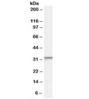 Western blot testing of human peripheral blood mononucleocyte lysate with PSME1 antibody at 0.3ug/ml. Predicted molecular weight: ~29kDa.