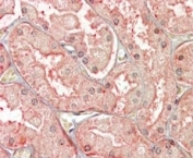 IHC testing of FFPE human kidney with SFRP1 antibody at 4ug/ml. HIER: steamed with pH6 citrate buffer, AP-staining. Vesicular staining is seen.