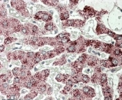 IHC testing of FFPE human liver with SCP2 antibody at 4ug/ml. HIER: steamed with pH6 citrate buffer, AP-staining.