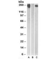 Western blot testing of HEK293 lysate overexpressing Human CSF1R with MYC tag with CSF1R antibody (0.5ug/ml) in Lane A and probed with anti-MYC tag (1/1000) in lane C. Mock-transfected HEK293 probed with CSF1R antibody (1ug/ml) in Lane B.
