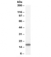 Western blot testing of human testis lysate with STMN1 antibody at 1ug/ml. Predicted molecular weight: ~17kDa.