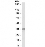 Western blot testing of human spleen lysate with CD4 antibody at 1ug/ml. Predicted molecular weight ~31kDa.