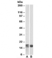 Western blot testing of human tonsil [A] and Jurkat [B] lysates with CD3 zeta antibody at 0.03ug/ml. Predicted molecular weight: ~19kDa.