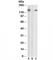 Western blot testing of HEK293 lysate overexpressing human NLRP2/NBS1 with DYKDDDDK tag with NBS1 antibody [1ug/ml] in Lane A and probed with anti-DYKDDDDK tag (1/5000) in lane C. Mock-transfected HEK293 probed with NBS1 antibody [1ug/ml] in Lane B.