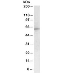Western blot testing of peripheral blood mononucleocyte lysate with G6PD antibody at 1ug/ml. Predicted molecular weight ~59kDa.