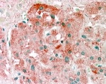 IHC testing of FFPE human adrenal gland with Semaphorin 3E antibody at 2.5ug/ml. HIER: steamed with pH6 citrate buffer, AP-staining.