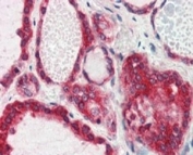 IHC testing of FFPE human thyroid gland with Lipin 3 antibody at 2.5ug/ml. HIER: steamed with pH6 citrate buffer, AP-staining.