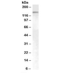 Western blot testing of HeLa cell nuclear lysate with SENP6 antibody at 0.5ug/ml. Predicted molecular weight: ~125kDa, observed here at ~150kDa.