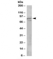 Western blot testing of human brain lysate with OSBPL11 antibody at 1ug/ml. Predicted molecular weight: ~86kDa.