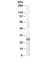 Western blot testing of human muscle lysate with APOBEC2 antibody at 1ug/ml. Predicted molecular weight: ~26kDa.