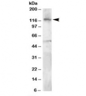 Western blot testing of Jurkat lysate with HLTF antibody at 0.5ug/ml. Predicted molecular weight: ~114kDa.
