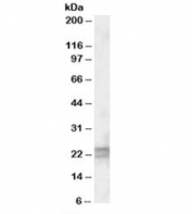 Western blot testing of human lung lysate with ARL6 antibody at 0.5ug/ml. Predicted molecular weight: ~22kDa.