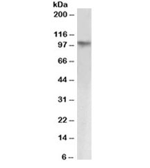 Western blot testing HeLa nuclear lysate with KAP1 antibody at 1ug/ml. Observed molecular weight: 88~110kDa depending on sumoylation level.