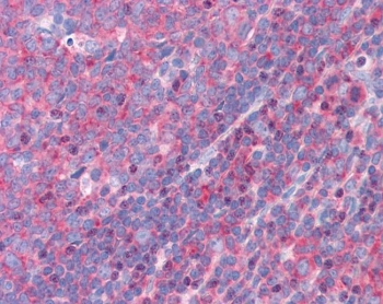IHC testing of FFPE human tonsil tissue with FBP17 antibody at 3.75ug/ml. Required HIER: steamed antigen retrieval with pH6 citrate buffer; AP-staining.