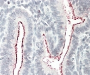 IHC staining of FFPE human uterus with P130Cas antibody at 5ug/ml. HIER: steamed with pH6 citrate buffer, AP-staining.