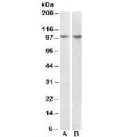 Western blot testing of MCF7 [A] and human breast cancer [B] lysates with P130Cas antibody at 1ug/ml. Predicted molecular weight: ~98kDa.