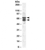 Western blot testing of 293 lysate with PPP2R5D antibody at 2ug/ml. Image shows isoforms of ~70kDa and ~60kDa.
