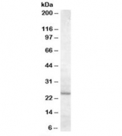 Western blot testing of human liver lysate with MTHFS antibody at 0.5ug/ml with [B] and without [A] blocking/immunizing peptide. Predicted molecular weight: ~23kDa.