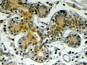 IHC testing of FFPE human breast with Klotho antibody at 4ug/ml. HIER: steamed with pH6 citrate buffer, HRP-staining.~