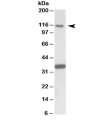 Western blot testing of human hippocampus lysate with KIT antibody at 1ug/ml. Observed molecular weight: ~120/145kDa (precusor/mature). Both observed bands are blocked by the immunizing peptide.
