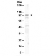 Western blot testing of human colon lysate with alpha Catenin antibody at 1ug/ml. Expected/observed molecular weight: ~102kDa.