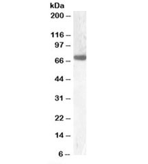 Western blot testing of rat liver lysate with GCKR antibody at 0.1ug/ml. Predicted molecular weight ~69kDa.
