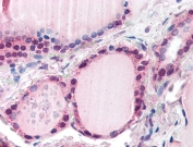 IHC testing of FFPE human thyroid with FBXL3 antibody at 5ug/ml. Required HIER: steamed antigen retrieval with pH6 citrate buffer; AP-staining.