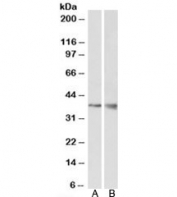 Western blot testing of mouse kidney (A) and brain (B) lysate with WNT9B antibody at 1ug/ml. Predicted molecular weight: ~38kDa.