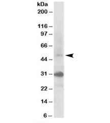 Western blot testing of human kidney lysate with FBXW2 antibody at 0.3ug/ml. Predicted molecular weight: ~51kDa. Both observed bands were blocked by addition of the immunzing peptide.~