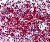 IHC testing of FFPE human spleen with DKC1 antibody at 5ug/ml. HIER: steamed with pH6 citrate buffer, AP-staining.