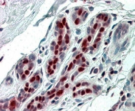 IHC staining of FFPE human breast with APRIL antibody at 4ug/ml. HIER: steamed with pH6 citrate buffer, AP-staining.