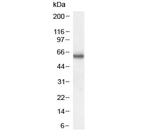Western blot testing of human lymphoblast cell lysate with CORO1A antibody at 0.3ug/ml. Predicted molecular weight: ~51 kDa, observed here at ~60 kDa.