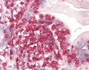 IHC testing of FFPE human small intestine tissue with CORO1A antibody at 3.75ug/ml. HIER: steamed antigen retrieval with pH6 citrate buffer; AP-staining.