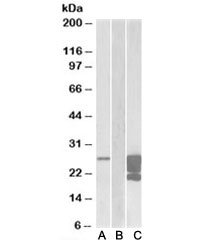 Western blot of HEK293 lysate overexpressing human GM2A-FLAG probed with GMA2 antibody (1ug/ml) in Lane A and anti-FLAG (1/30000) in lane C. Mock-transfected HEK293 probed with GMA2 antibody (1ug/ml) in Lane B. Predicted molecular weight ~22kDa.~