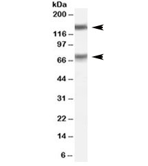 Western blot testing of human testis lysate with MELK antibody at 0.1ug/ml. Predicted molecular weight: ~75/150kDa (unmodified/glycosylated).