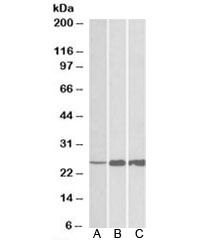 Western blot testing of human [A], mouse [B] and rat [C] skeletal muscle lysate with TNNI2 antibody at 0.03ug/ml. Predicted molecular weight: ~21kDa, observed here at ~25kDa.
