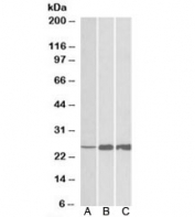 Western blot testing of human [A], mouse [B] and rat [C] skeletal muscle lysate with TNNI2 antibody at 0.03ug/ml. Predicted molecular weight: ~21kDa, observed here at ~25kDa.