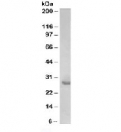 Western blot testing of human prostate lysate with p27Kip1 antibody at 0.1ug/ml. Predicted molecular weight ~27kDa.