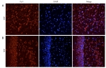 IHC staining of FFPE rat cerebral cortex [A] and rat hippocampus [B] with CHRNA antibody at 5ug/ml; DAPI nuclear counter stain (blue); HIER: pH6 citrate buffer at 95-98oC.
