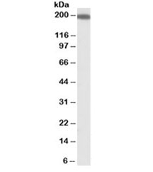 Western blot testing of human kidney lysate with IQGAP1 antibody at 1ug/ml. Predicted molecular weight ~189kDa.