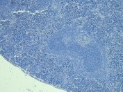 Negative control: IHC staining of FFPE mouse spleen tissue without Scurfin antibody. Required HIER: steamed antigen retrieval with pH6 citrate buffer.