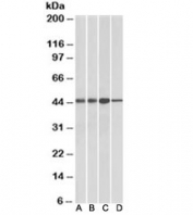 Western blot of mouse (A) and rat (B) kidney lysates, and mouse (C) and rat (D) liver lysates with ACAT1 antibody at 0.01ug/ml. Predicted molecular weight: ~45kDa.