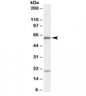 Western blot testing of HeLa cell lysate with BMPR1A antibody at 1ug/ml. Molecular weight: he expected ~60kDa band and additional ~20kDa band are both blocked by the immunizing peptide.