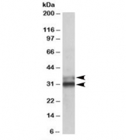 Western blot testing of human colon lysate with ETFA antibody at 0.1ug/ml. Predicted molecular weight: ~35/30kDa (isoforms 1/2).