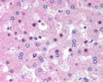 IHC testing of FFPE human liver with C14orf68 antibody at 2.5ug/ml. HIER: steamed with pH6 citrate buffer, AP-staining.