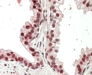 IHC testing of FFPE human prostate with HOXD13 antibody at 4ug/ml. HIER: steamed with pH6 citrate buffer, AP-staining.