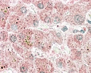 IHC staining of FFPE human liver with Apolipoprotein F antibody at 4ug/ml. HIER: steamed with pH6 citr